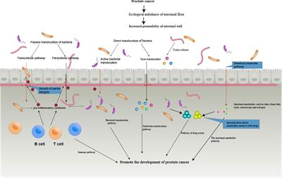 Potential role of gut microbiota in prostate cancer: immunity, metabolites, pathways of action?